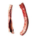 Buffalo Trachea